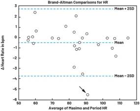 動(dòng)態(tài)離散周期變換技術(shù)突破:無(wú)ECG參考的生理信號(hào)精準(zhǔn)解析 動(dòng)態(tài)離散周期變換技術(shù)突破:無(wú)ECG參考的生理信號(hào)精準(zhǔn)解析