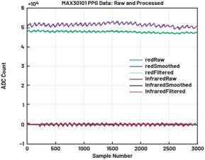 動(dòng)態(tài)離散周期變換技術(shù)突破:無(wú)ECG參考的生理信號(hào)精準(zhǔn)解析 動(dòng)態(tài)離散周期變換技術(shù)突破:無(wú)ECG參考的生理信號(hào)精準(zhǔn)解析